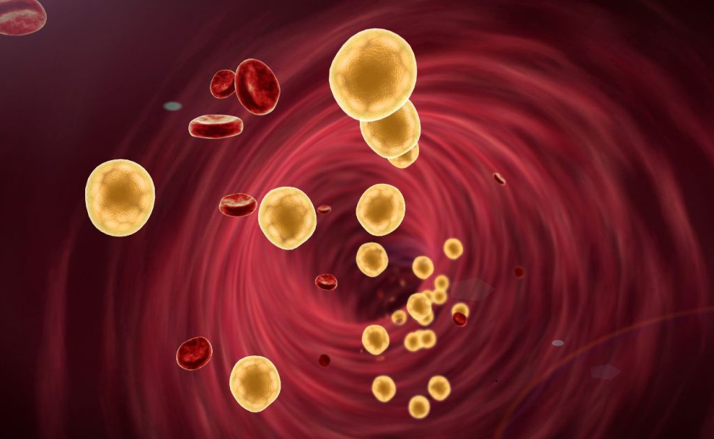 Colesterol, Trigliceride și Homocisteină: Ce Spun Analizele Despre Sănătatea Ta Metabolică