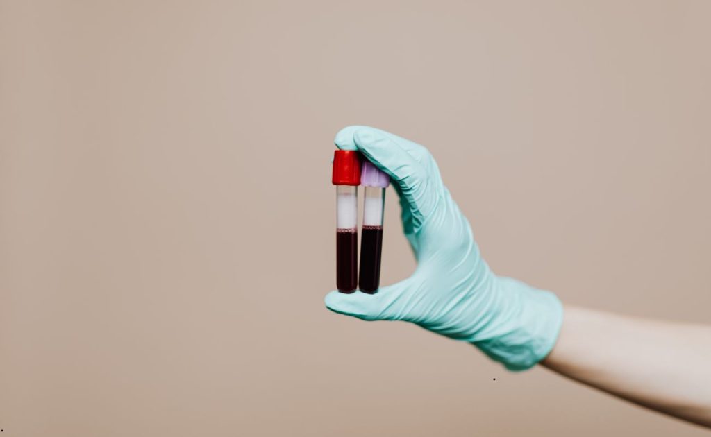 Ce analize poți face cu doar 2000 RON ca să înțelegi cum îmbătrânește corpul tău?